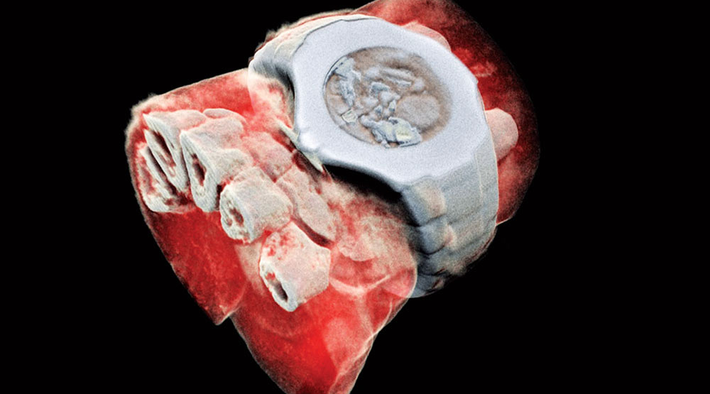 First human 3D X-ray in colour – CERN Courier