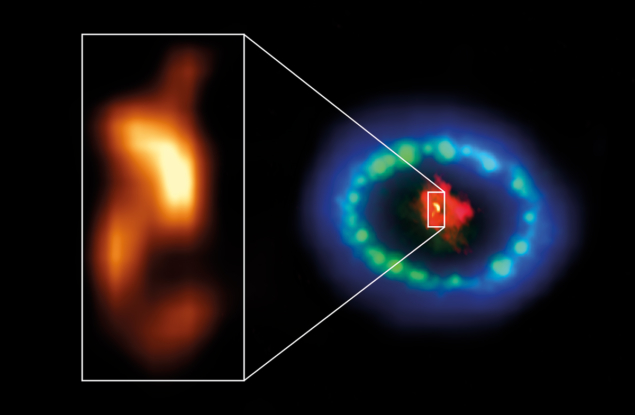 The dusty core of SN1987A