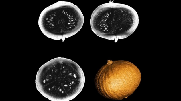 MRI pumpkin