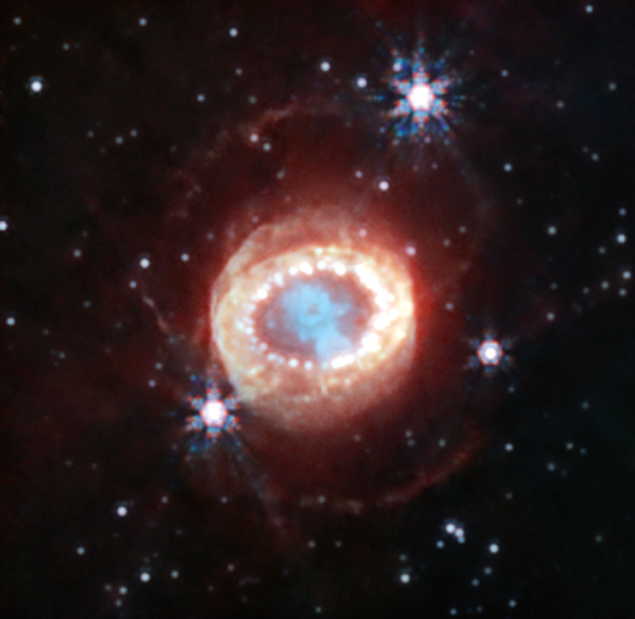 SN1987A