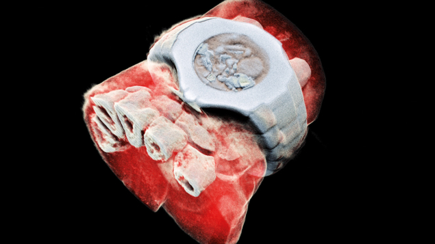 A spectroscopic X-ray image