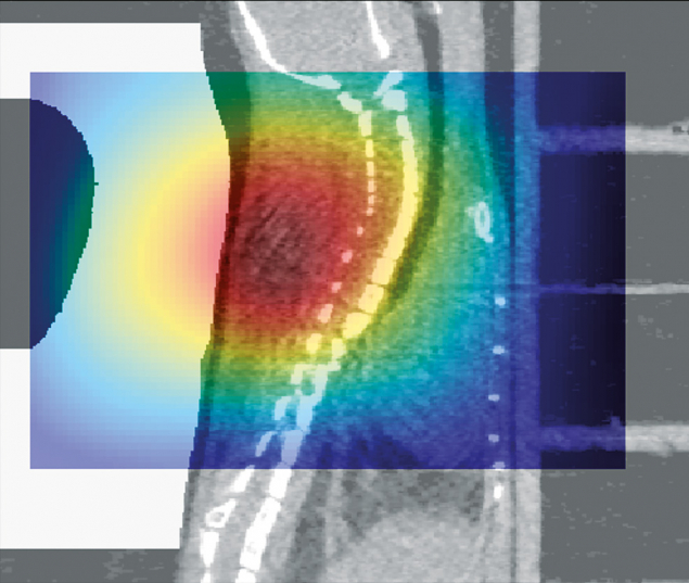 Radioactive-ion therapy